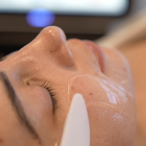 Aplicación de Gel